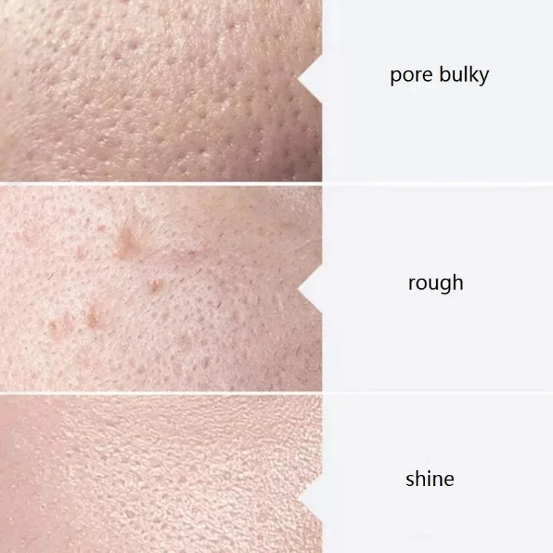 Facial Serum Kit – 3 x 400ml Aqua Peel Solutions