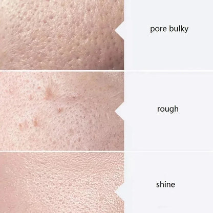 Facial Serum Kit – 3 x 400ml Aqua Peel Solutions